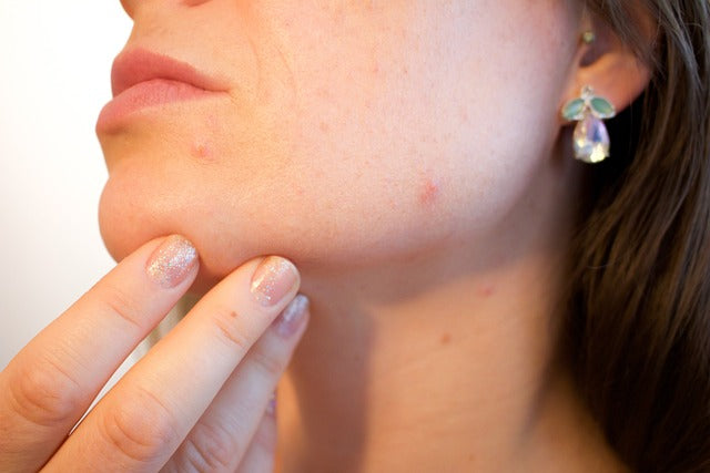 美顔器はニキビに効果ある？おすすめの美顔器とニキビが悪化すると言