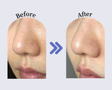 ANACIS(アナシス)/アクレオンセボエクストラクター