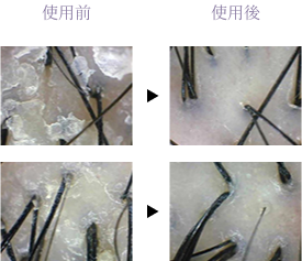 使用前と使用後の頭皮の変化