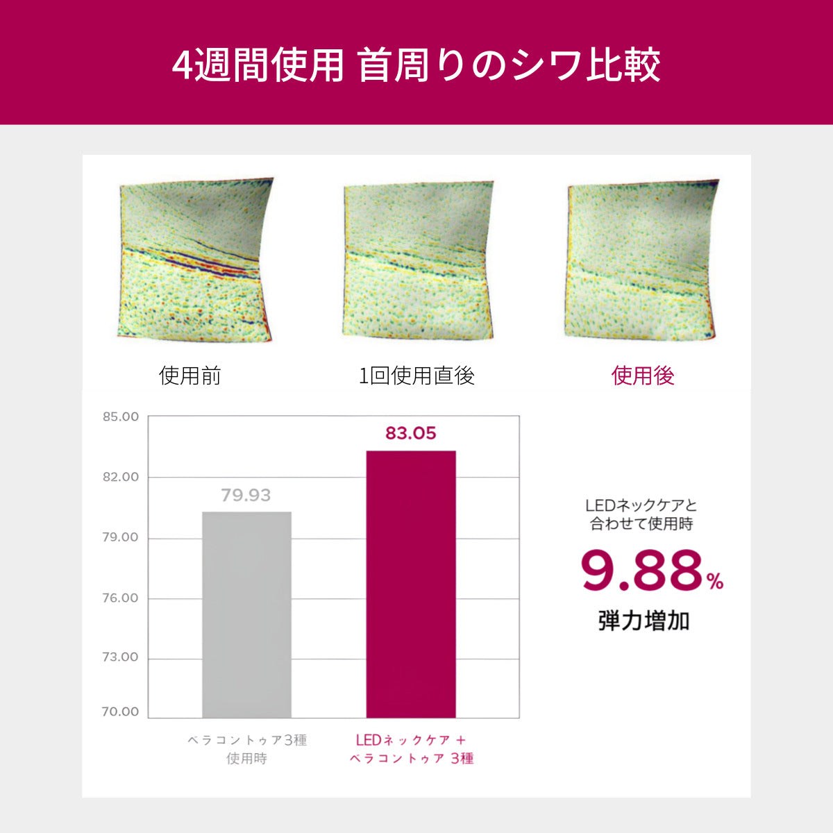首のシワ 専用美顔器 VリフトLEDネックケア美顔器 | 首のシワ・たるみ