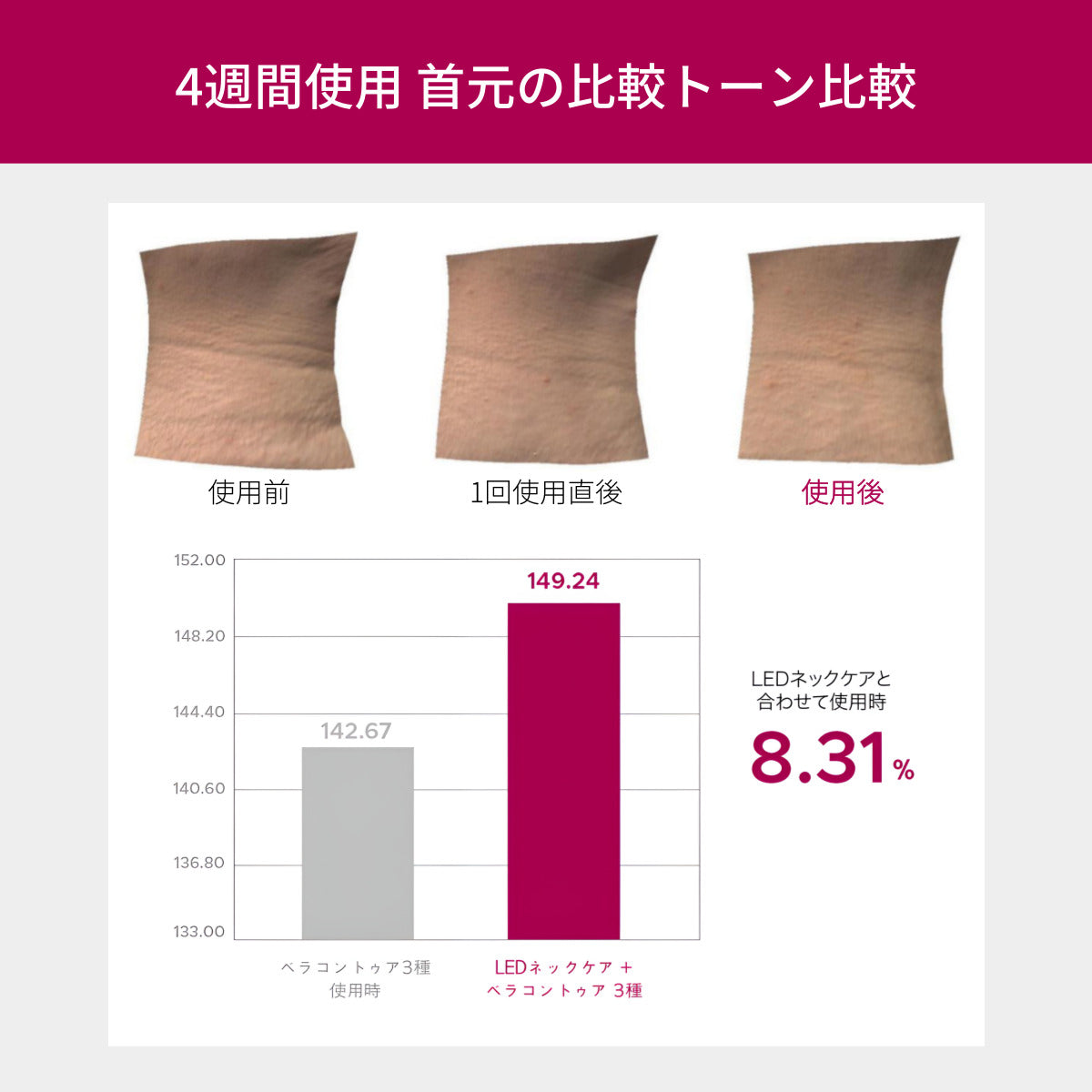 首のシワ 専用美顔器 VリフトLEDネックケア美顔器 | 首のシワ・たるみ