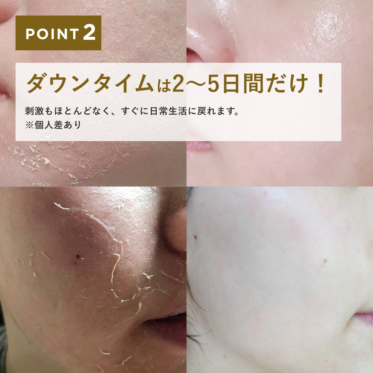ダーマスキンピーリング｜BQCELLの使い方を徹底解説 - ✨✨  72