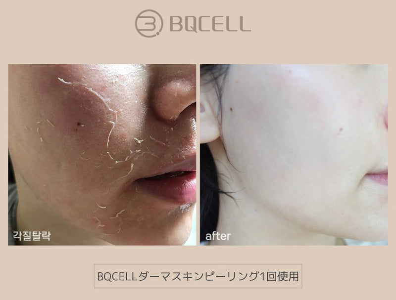 BQCELL(ビーキューセル)/むき卵肌セット　